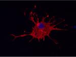 Human microglia. Image copyright Life & Brain